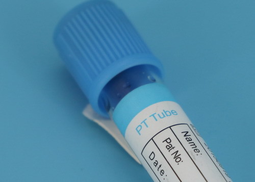 Wholesale Medical Disposable Centrifuge Tube / Blood Collection Tube CE ISO Approved from china suppliers