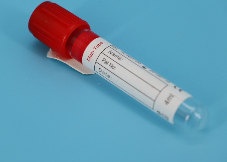 Wholesale Vacuette Evacuated Blood Sample Centrifuge Tube For Medical Laboratory Use from china suppliers