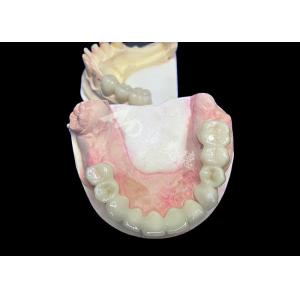 China Natural Looking Lava Zirconia Crown With Unrivaled Durability Excellent Biocompatibility on sale