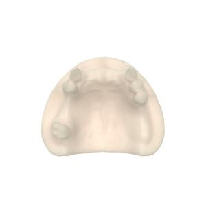 DLP LCD Dental Engineered Opposite Jaw Model Resin