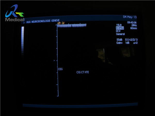 8MHz Ultrasound Transducer Probe Siemens Acuson Sequoia Broadband Linear 15L8