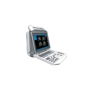 SUCE-I50 12.1'' Digital Ultrasound machine