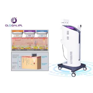 Ultrasound Face Lifting HIFU Machine 25000 Shots Self Developed Patent