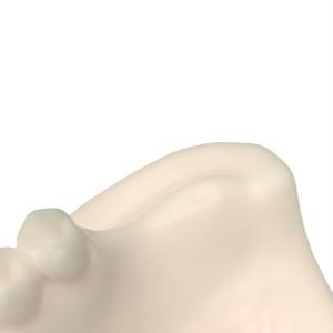 DLP LCD Dental Engineered Opposite Jaw Model Resin