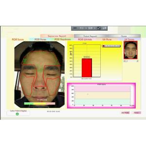 Magic Mirror System Skin Analyzer Skin Tester for deep skin problems