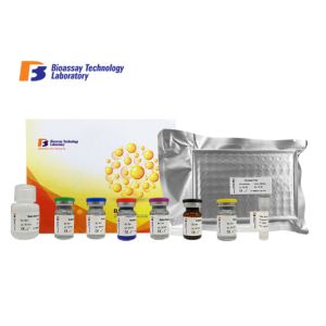 Wholesale Laboratory Research Human ELISA Kit YKL-40 CHI3L1 Enzyme - Linked Immunosorbent Assay Kit Customized from china suppliers