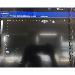 Surgical Sector Array Ultrasound Machine Probes Toshiba PSU-30BT 5S2