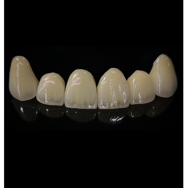 Comfortable Zirconia Crown With Good Fitting And Precision Esthetics