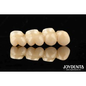 Ultra-precision processing Zirconia Implants All-Zirconium Integrated Crown