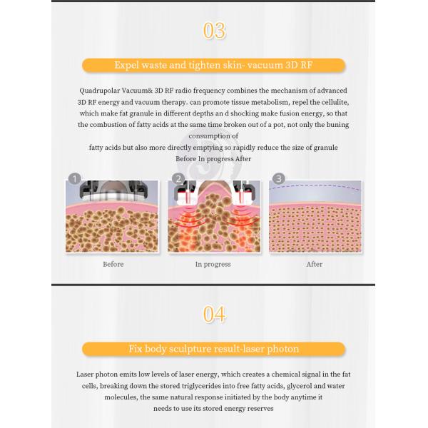 Customized 80k Cavitation Machine , 6 In 1 Cavitation Radio Frequency Machine