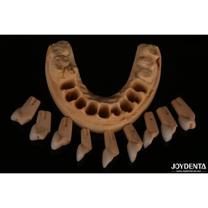 Wholesale Precise Fit Dental Feldspathic Veneer Highly Natural With Glossy Surface Texture from china suppliers