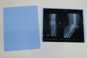 China Blue PET Inkjet Medical X Ray Film For Epson Printer on sale