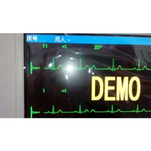 12.1 Inch 6 Paramters Portable Vital Signs Monitoring Machine For ICU Patient
