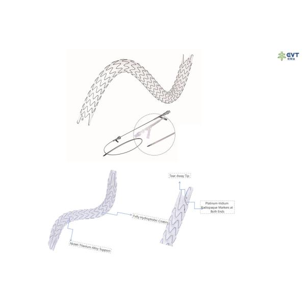 Precision Placement Ureteric Stents Hydrophobic Surface And X Ray Visibility