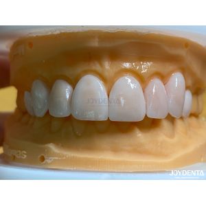 Wholesale High Permeability Natural Looking Veneers Porcelain Veneers Emax Customized from china suppliers
