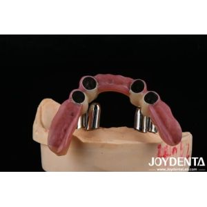 Wholesale Dental Precision Attachments Supports Partial Dentures Accurate Restorations from china suppliers