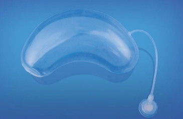 Quality Shape of Kidney Tissue Expander for Implantable Expander for sale