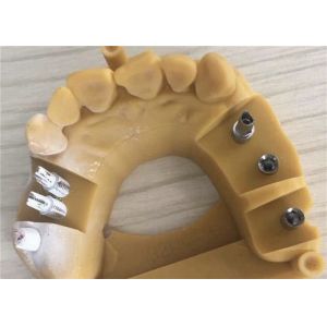 Digital Biocompatibility PFM Dental Crown 3D Printing Temporary Crowns