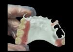 High Quality Comfortable Partial Denture With HPP Framework Restores Chewing And