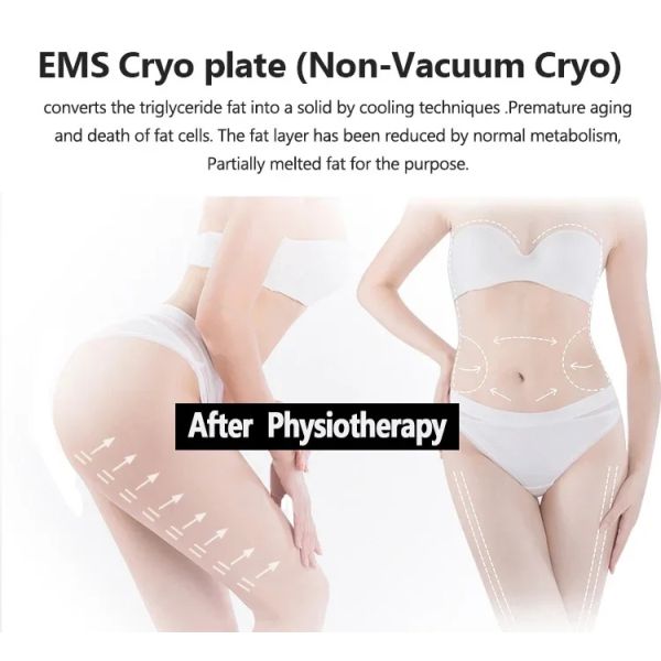 Portable 2 in 1 Fat Freezing EMS Cool Device with 4 Handles for Cellulite Reduction and Minus 10 Degree for Beauty Salon Use