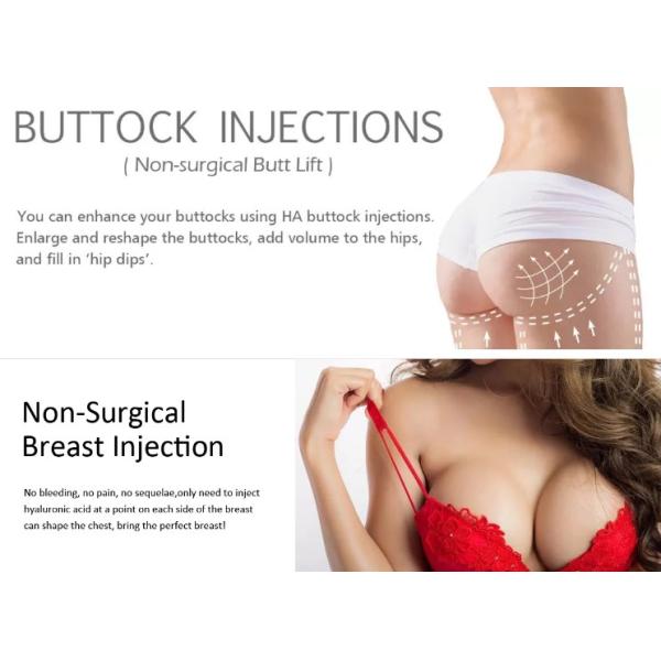 Buttock Augmentation Dermal Filler Injection Butt Enlargement