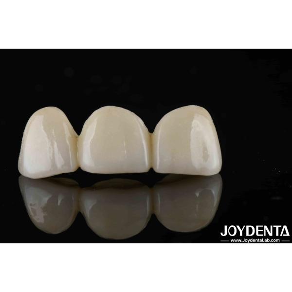 Quality Natural-looking Style With Layers Full Zirconia High Translucency And Aesthetics for sale