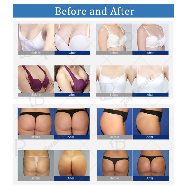 Top Beauty Vacuum Butt Lifting Machine Professional