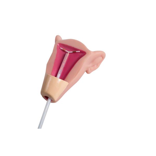 Insertion Placement Gynecologic IUD Training Simulator