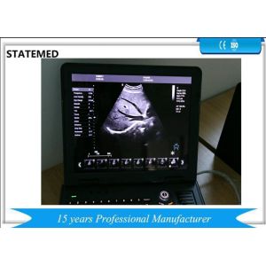 Digital Portable Ultrasound Equipment / Small Ultrasound Machine 128 Elements
