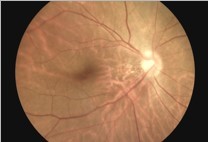 Store Images And Videos Portable Fundus Camera