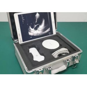 Wifi Handheld Ultrasound Scanner Portable Convex Linear Cardiac Multifrequency