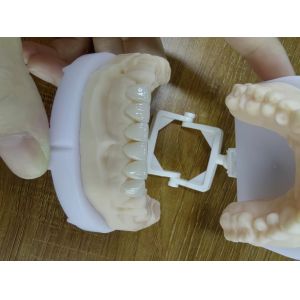 EMax Veneer Cases Passive Fitting In Multiple Colors MAKE Beautiful Smile With