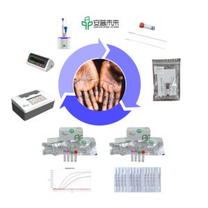 Mpox multi-enzyme constant temperature rapid nucleic acid amplification overall
