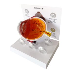 Medical Science Anatomy Type Human Pathology Eye Model For Display Education