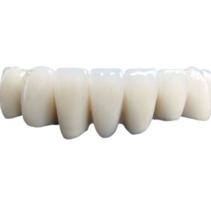 Porcelain Dental Crown Realistic Appearance Confident And Beautiful Color Stable