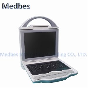 Portable Bone Density Machine Densitometer Ultrasound Bone Densitometer