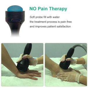 Difference between Focused and Radial Shockwave Therapy Machine Maximum