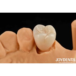 Natural-looking Esthetics With Biocompatible Dental Zirconia Winning Combination