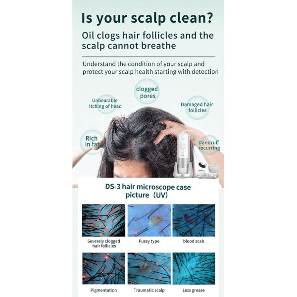 Customizable Scalp Analysis Machine For Dryness And Dandruff Problem