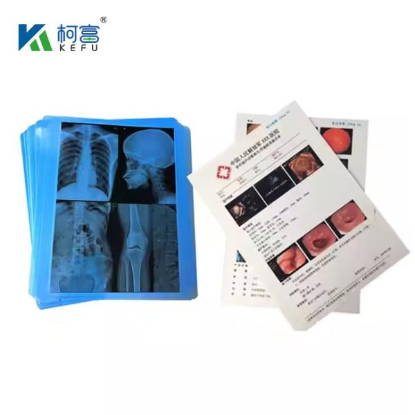 Medical Laser Film With High Color Accuracy And Fidelity 14x18in 0.16mm For True