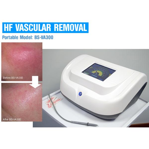 High Frequency Vascular / Spider Vein Removal Machine , Laser Varicose Vein