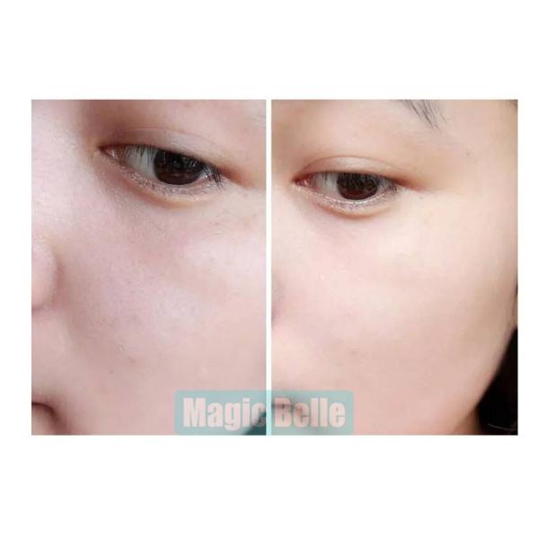 Micro Machine Hydromassage Jet Peel lipo laser slimming machine Small Bubble For Home