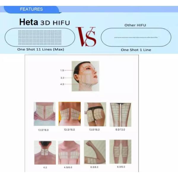 150VA Hifu Skin Tightening Machine 8 Cartridges hifu face lifting machine