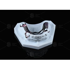 Sensitive Skin High Strength Titanium Framework Solution 3D Printed