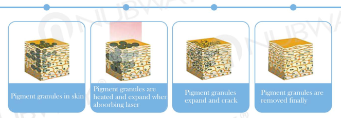 1064nm 532nm Q switch nd yag laser pulsed dye laser for tattoo removal vascular and skin rejuvenation