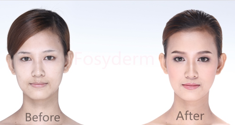 Colorless 2.5ml Meso Hyaluronic Acid Gel Injection Face HA Mesotherapy Solution