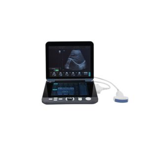 256 Frame Cine Portable Ultrasound Scanner 128 Permanent Storage With 12 Inch