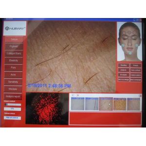 2,000,000 pixel Skin analyzer machine digital analysis software polarizing lens