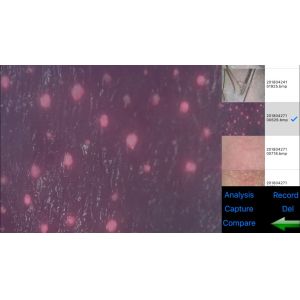 3 H Continuous Working Handheld Skin Analyzer Digital Checking Moisture Pigment