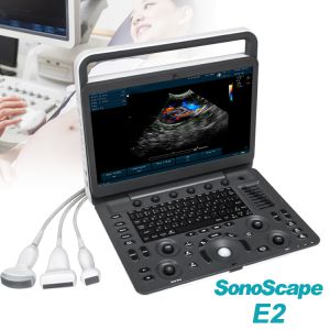 High Quality Ultrasonic SonoScape E2 with Ultrasonic Sensors